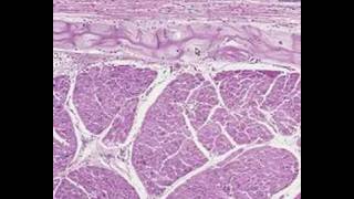 Shotgun Histology Heart Purkinje Fibers [upl. by Waters]