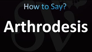 How to Pronounce Arthrodesis Correctly [upl. by Atinehs953]