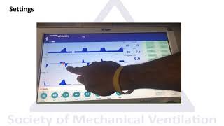 Modes of mechanical ventilation Mandatory Minute Ventilation MMV [upl. by Ciapha27]