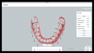 arch form autoalign [upl. by Deacon]