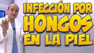 Diferencias entre aftas y herpes [upl. by Brinna]