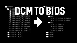 DICOM to BIDS conversion [upl. by Sou]