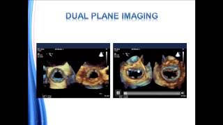 Guidelines for Performing a Comprehensive Transesophageal Echocardiographic Examination [upl. by Oicul]