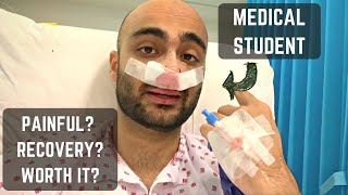 Underwent surgery 3 days before med school finals  Septoplasty VLOG  Advice [upl. by Akkahs223]