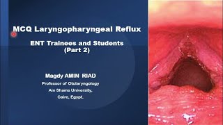 MCQ Laryngopharyngeal Reflux ENT Trainees and Students Part 2 [upl. by Doownil967]