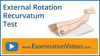 External Rotation Recurvatum Test [upl. by Bayard]