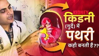 FullVideo👉HUMAN KIDNEY amp KIDNEY STONE  किडनीगुर्दे अंदर से कैसी होती है और इसमें पथरी कहाँ बनती है [upl. by Mersey]