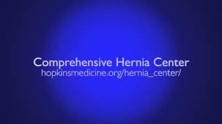 Hernia Surgery Complex Hernia Repair [upl. by Ecitnirp]