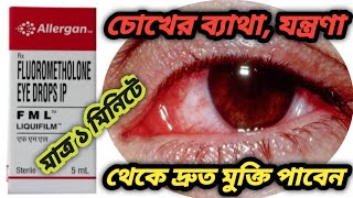 FML eye drops benefits use in bengali review How to benefits in FML eye drops [upl. by Ilime]