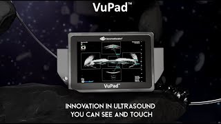 VuPad  Innovation in Ultrasound You Can See and Touch [upl. by Aicyla]