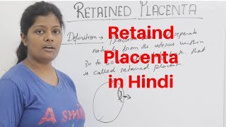 Retained Placenta Lecture in Hindi with Types amp Grades  Complication amp Management [upl. by Fagen93]