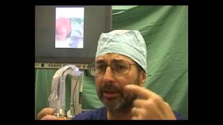 Awake endotracheal intubation with Pentax AWS videolaryngoscope [upl. by Paule935]