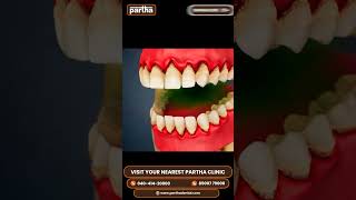 Periodontics Treatment at Partha Dental  Expert Care for Your Gums [upl. by Abe]