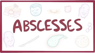 Abscesses  causes symptoms diagnosis treatment pathology [upl. by Atsiuqal]