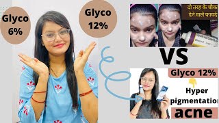 Glyco 6 cream VS Glyco 12 cream  acne prone skin  hyperpigmentation Kiransrana [upl. by Tabb]