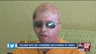 Second most wounded Iraq soldier recovering in Tampa [upl. by Sevik]