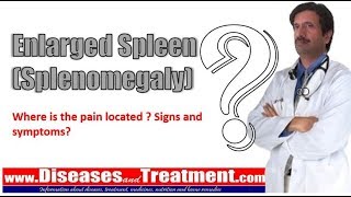 Enlarged Spleen Splenomegaly Where is the pain located  Signs and symptoms [upl. by Nortna]