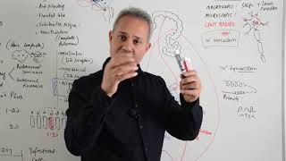 Morphology of Dopaminergic Neurons in Parkinsons Disease [upl. by Nomra]