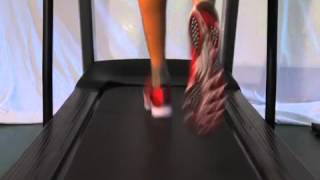 Flatfeet advice for runners [upl. by Luehrmann667]