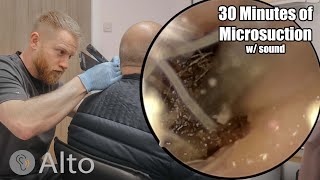 30 Minutes of MICROSUCTION Ear Wax Removal [upl. by Hess]