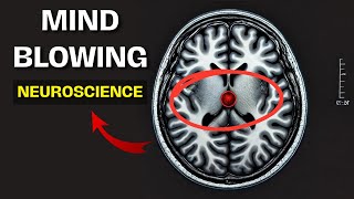 SplitBrain Surgery The Hidden Truth About Free Will and Consciousness  MindBlowing Neuroscience [upl. by Narol]