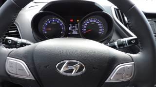 Hyundai HB20 S 16 é bom Opinião Real do Dono Pontos Positivos e Negativos Parte 2 [upl. by Sivehc]