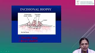 Dr Ambika Department of Oral Pathology Biopsy and Exfoliative Cytology [upl. by Airamesor]