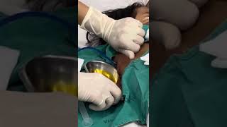 Remove lung abscess 🫁 infection long time [upl. by Eynenihc]