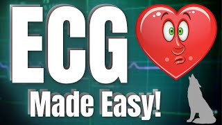 ECG Interpretation  Made EXTREMELY Easy [upl. by Carolee]