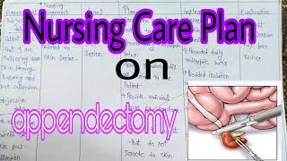 NCP  Nursing Care Plan on appendectomy  appendectomy  NCP on appendectomy by RAJEEV GUPTA [upl. by Renmus]