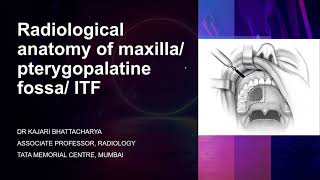 Radiological anatomy of maxillapterygopalatine fossa infratemporal fossa  Dr Kajari Bhattacharya [upl. by Luapnhoj]