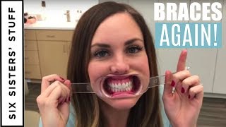 ADULT BRACES vs INVISALIGN  My Orthodontist Consultation [upl. by Enilada]