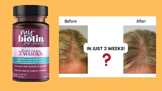 My Biotin Pro Clinical Dont Buy Until You Know This [upl. by Atinahc]