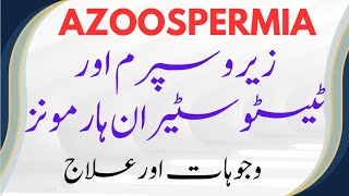 azoospermiatestosteronharmonstestosterone kya hota haiزیرو سپرم [upl. by Ehtyde776]