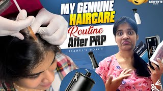 My Hair Care Routine After PRP Treatment  Tips for Healthy Hair Growth haircare hair [upl. by Zackariah180]