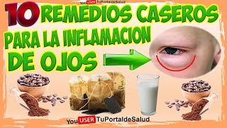 Como Curar la Inflamación de Ojos o Blefaritis con 10 Remedios Caseros [upl. by Amol337]