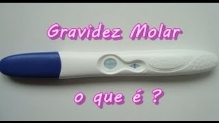 Mola Hidatiforme ou Gravidez Molar  Como acontece e tratamentos [upl. by Zorina]