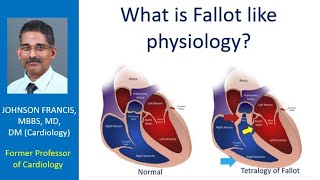 What is Fallot like physiology [upl. by Anicnarf]