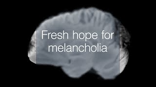 Depression research brings fresh hope for melancholia sufferers [upl. by Manheim]