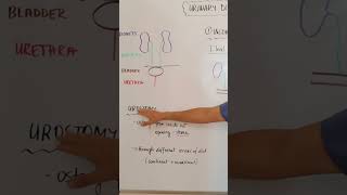 Urostomy nursingskills nursingstudent nursing [upl. by Suqram]