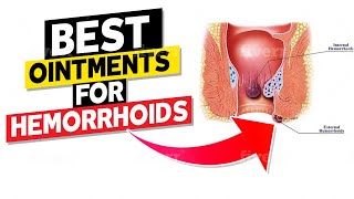 Best Ointments for Hemorrhoids [upl. by Goldstein]