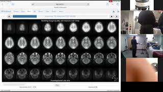 DEMO Hyperfine Bedside MRI [upl. by Ydnarb383]