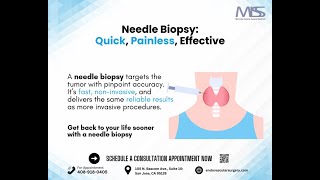 Needle Biopsy in Three Words Quick Painless Effective [upl. by Olbap]