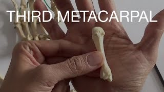 THIRD METACARPAL [upl. by Lucie]