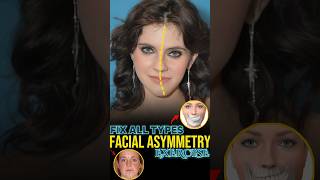 Fix Asymmetrical Face [upl. by Azeret]