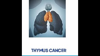 thymoma with pleural mets [upl. by Tellford]