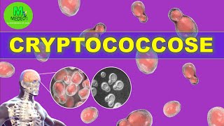 CRYPTOCOCCOSE  cours de mycologie médicale [upl. by Eceerahs]