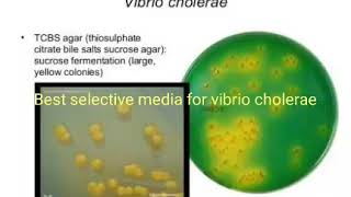 TCBS Selective culture media for Vibrio Cholerae [upl. by Simonetta]