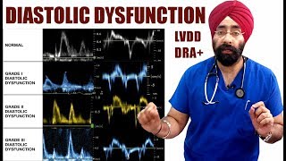 Rx Heart 19 Eng Diastolic Dysfunction  LVDD  Diastolic Heart Failure  DRA ENG DrEducation [upl. by Papotto]