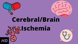 CerebralBrain Ischemia Causes Signs and Symptoms Diagnosis and Treatment [upl. by Tiernan]